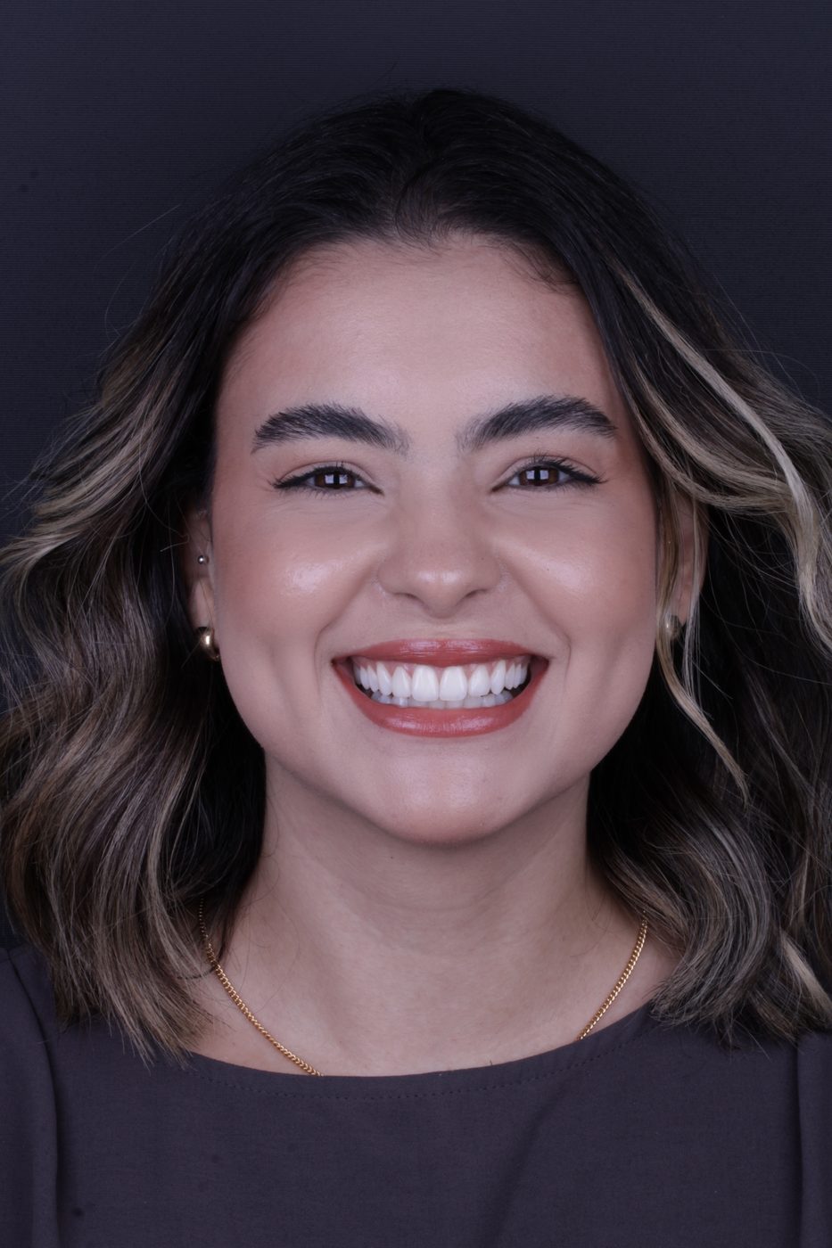 Paciente sorrindo após facetas em resina